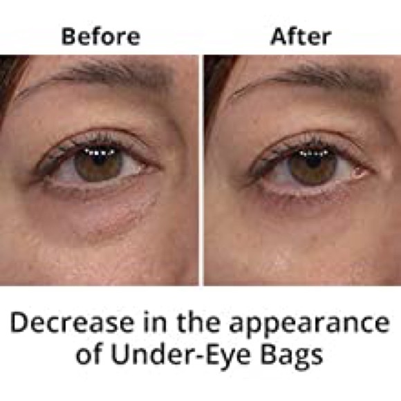 ⚜️Plexaderm Skin Care Rapid Reduction Serum! - Picture 4 of 8